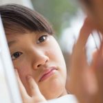 ニキビに悩む女子