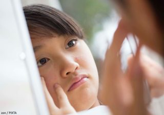 ニキビケアには固形石鹸が良い? 皮膚科医が教える「正しい洗顔」