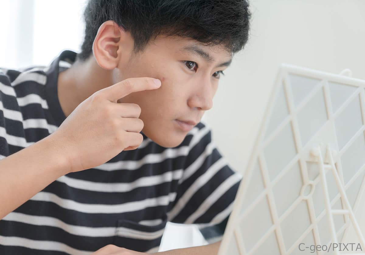 ニキビと遺伝は関係ある? 「肌トラブルに悩む子」の親が知ってほしい正しい知識の画像1