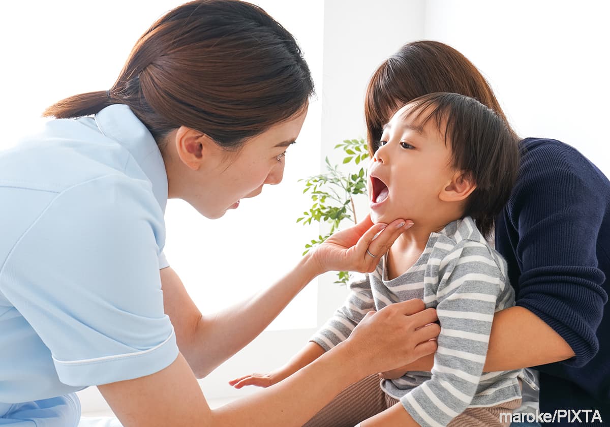 歯科検診をする子ども